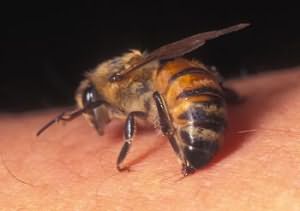 К чему снится укус пчелы